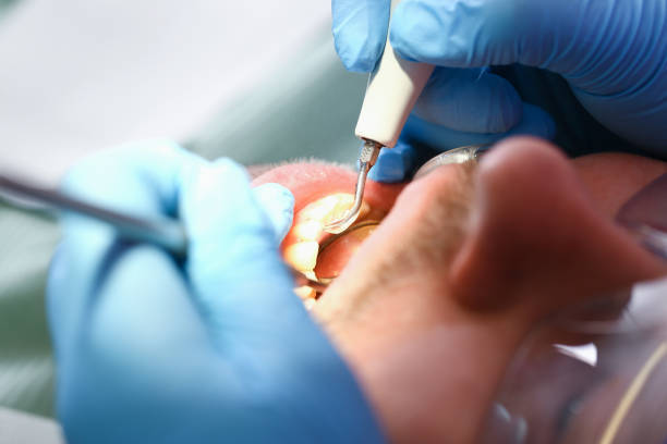 Best Dentist Open Late Near Me  in Mccom, OH