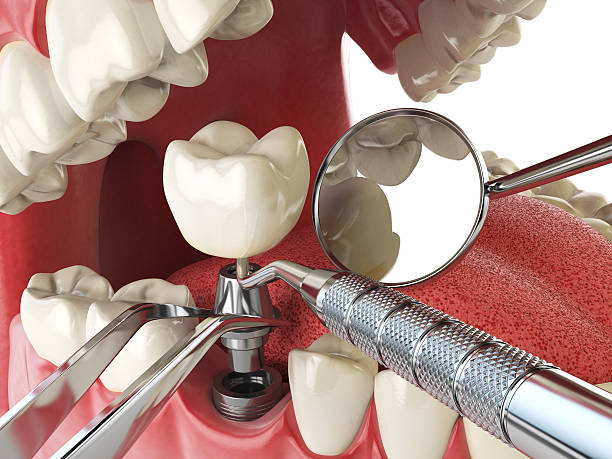 Best Urgent Dental Care  in Mccom, OH