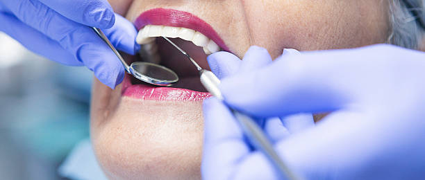 Best Teeth Whitening  in Mccom, OH