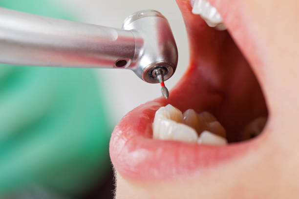 Best Walk-In Dentist Near Me  in Mccom, OH